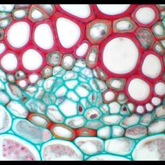 Ranunculus root - phloem strand seen in cross section of a mature root