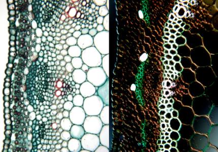Druses in cortex parenchyma cells seen in cross section of Medicago stem