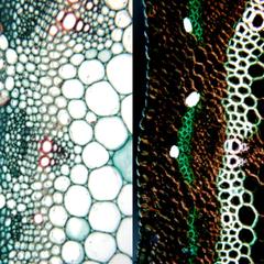 Druses in cortex parenchyma cells seen in cross section of Medicago stem