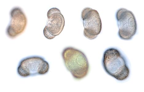 Several views, at different planes of focus, of a live pine pollen grain - 100x objective