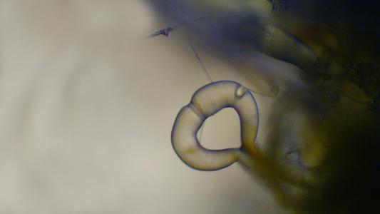 Progametangia in culture of Phycomyces