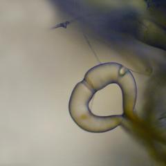 Progametangia in culture of Phycomyces
