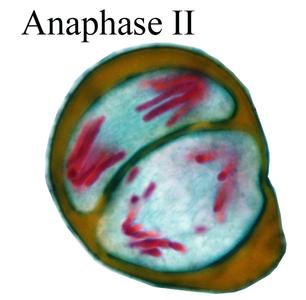 Anaphase II - Lilium microsporogenesis