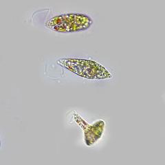 Euglena - a composite of different views of the same cell - 100x objective DIC illumination