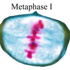 Metaphase I - Lilium microsporogenesis