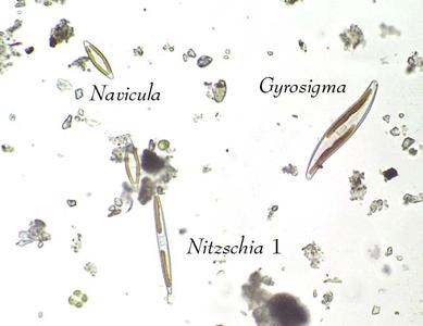 Diatoms - view of three different pennate diatoms