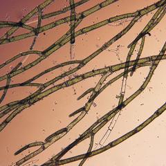 Cladophora - branched filaments
