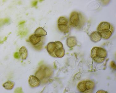 Hornwort - crushed sporangium showing tetrad of spores