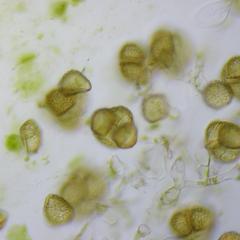 Hornwort - crushed sporangium showing tetrad of spores