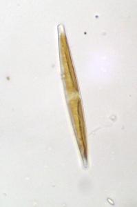 Nitzschia, a pennate diatom