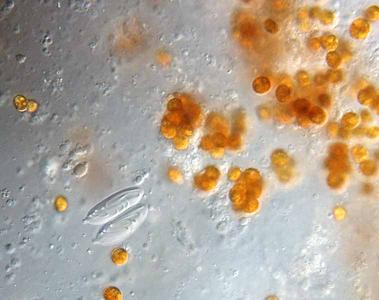 Zooxanthellae  with nematocysts of macerated pancake anemone tissue 60x objective