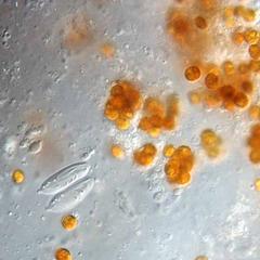 Zooxanthellae  with nematocysts of macerated pancake anemone tissue 60x objective