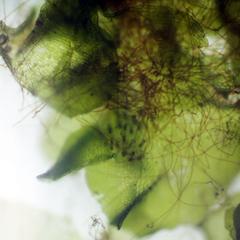 Rhizoids and archegonia of fern gametophyte