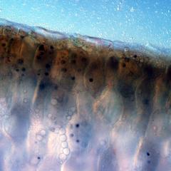 View of peanut tissue stained with iodine revealing starch grains and lipid droplets in the tissue.