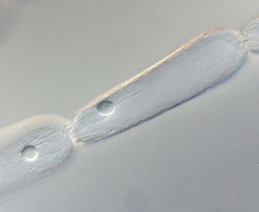 Stamen hair cells of Tradescantia showing cellular detail