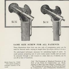 Charnley's Compression Screw advertisement