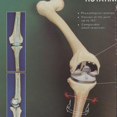 Endo-Model Total Knee System advertisement