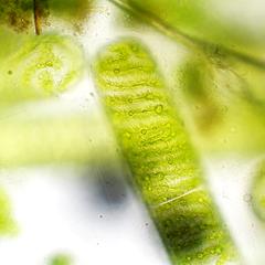 Spirogyra - apical cell with view of the chloroplast with pyrenoids