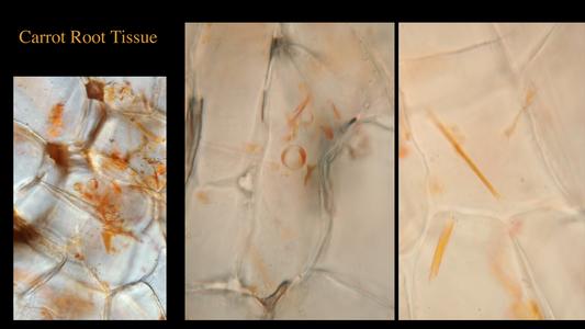 Composite of three views of carrot root tissue, two showing pigment bodies at different magnifications, and the other an intact chromoplast