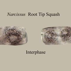 Interphase from a Narcissus root squash