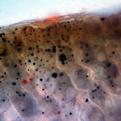 View of peanut tissue treated with iodine showing purple starch grains and unstained droplets of oil