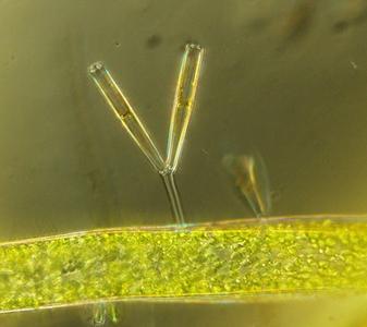 Sessile stalked pennate diatoms