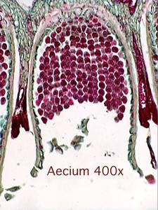 Berberis vulgaris - aecium in cross section of an infected leaf