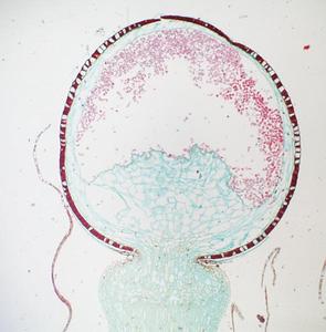 Longitudinal section through the sporophyte of Sphagnum moss