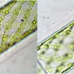 Spirogyra - two views of the same cell