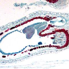 Ovule with heart shaped embryo of Capsella