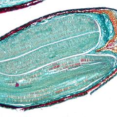 Mature ovule of Capsella