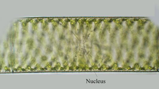 Spirogyra nucleus labelled