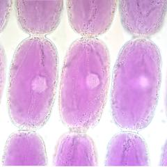 Stamen hair of Setcreasea : five views at different focal planes