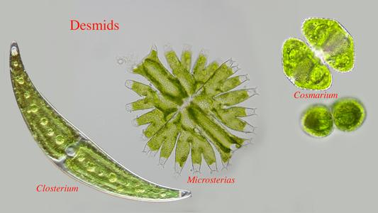 Composite of three desmids, Micrasterias, Cosmarium and Closterium