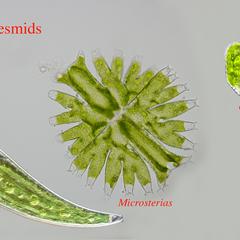 Composite of three desmids, Micrasterias, Cosmarium and Closterium