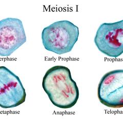 Composite of cells in each stage of meiosis I of Lilium microsporogenesis