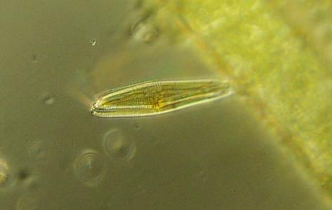 Diatoms - stalked pennate diatom - oblique view