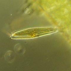 Diatoms - stalked pennate diatom - oblique view