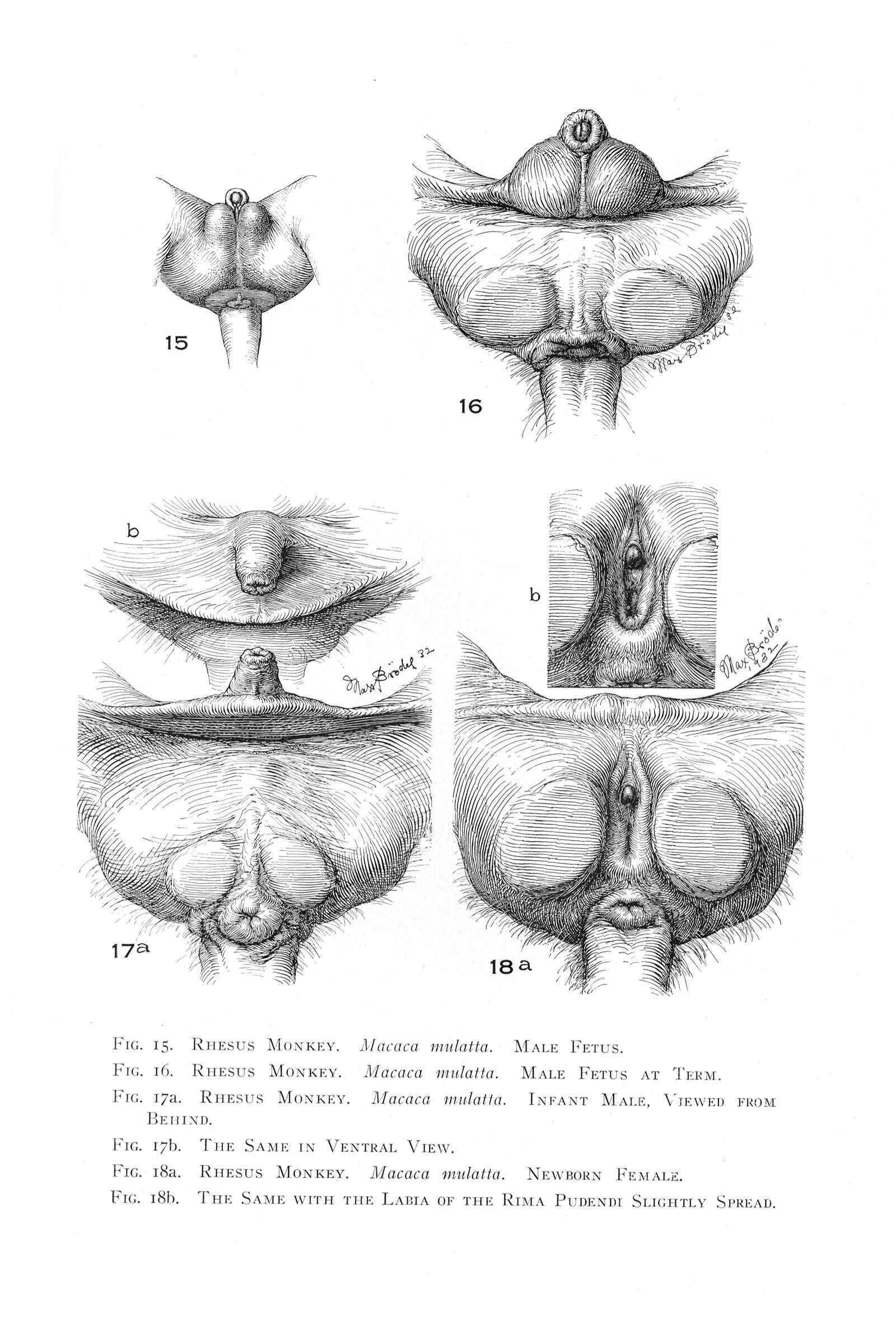 The labia libraries 👉 👌 What Is A Hooded Clitoris - dni-tang