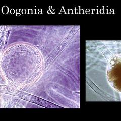 Saprolegnia - two views of oogonium of different ages with antheridia