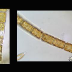 Detail of girdle view of Melosira, a filamentous centric diatom