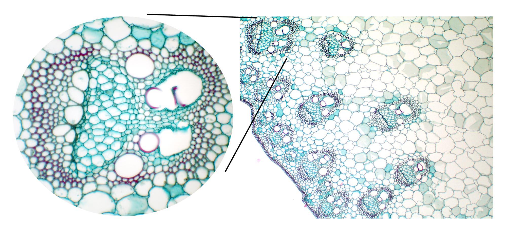 ‎composite Of Scattered Vascular Bundles With Detail Of One Bundle In