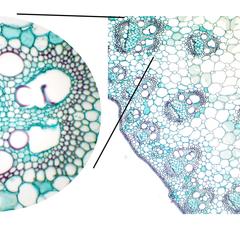 Composite of scattered vascular bundles with detail of one bundle in cross section of Zea stem