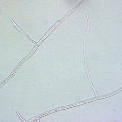 Coenocytic hyphae of Rhizopus