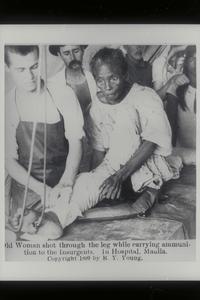 Elderly woman receiving treatment for a gunshot wound in the leg received when aiding insurgents, Manila, 1899