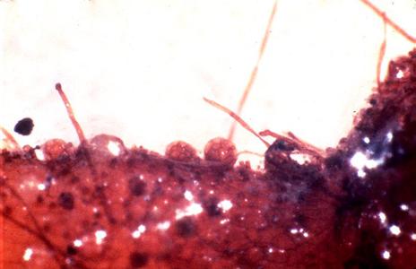 Psilotum gametophyte with an antheridium