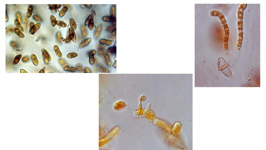 Composite of germinating teliospores with basidia and basidiospores of Cedar apple rust