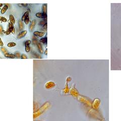 Composite of germinating teliospores with basidia and basidiospores of Cedar apple rust