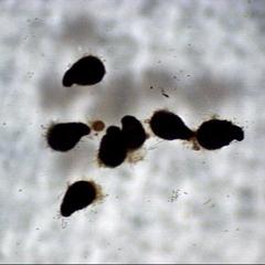 Parathecia of Sordaria as viewed on the agar of the culture