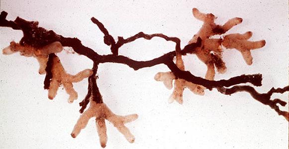Mycorrhizae of pine